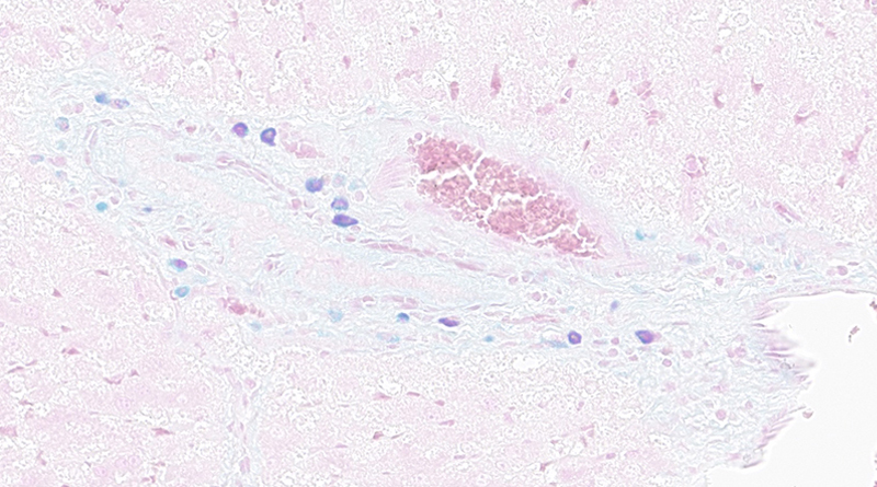 大鼠肝脏 肥大细胞染色 40X