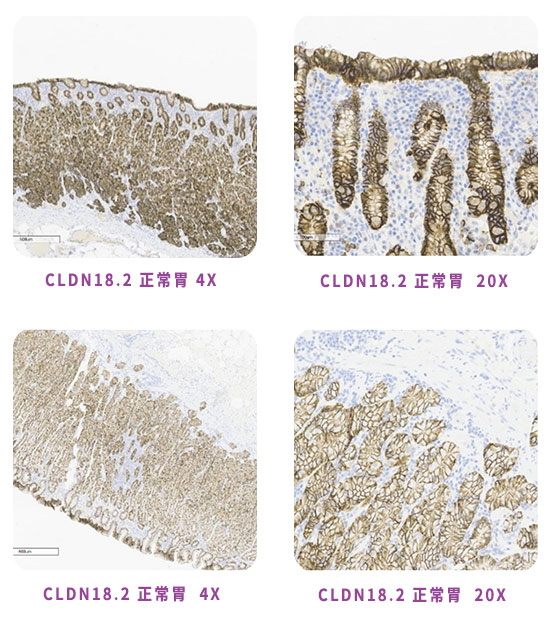 CLDN18.2抗体开发