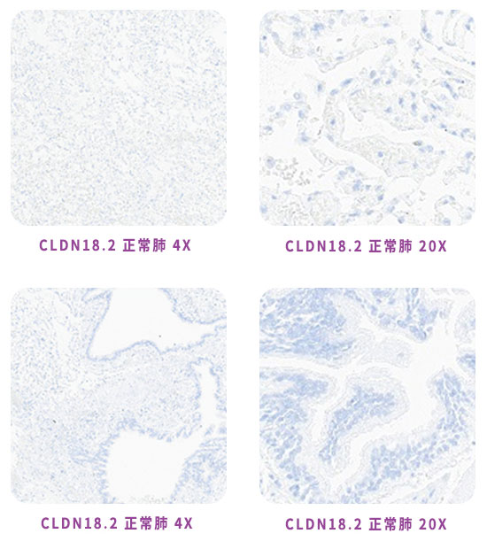 CLDN18.2抗体开发