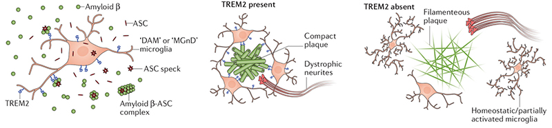   TREM2调控小胶质细胞参与Aβ病理过程 