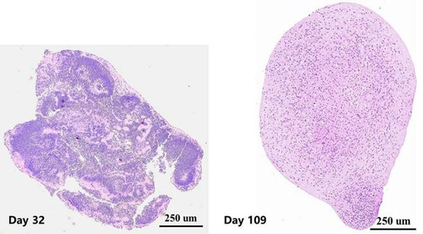 Left: Early-stage cerebral organoid show rosette-like structures (neural stem cells)