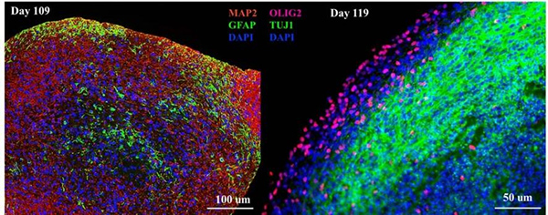 Immunostaining of Cerebral Organoids show expression of glia cell markers