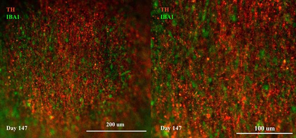 Immunostaining of Cerebral Organoids show expression of IBA1 marker